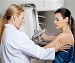 Removing modest fee boosts access to 3D mammography among underserved groups